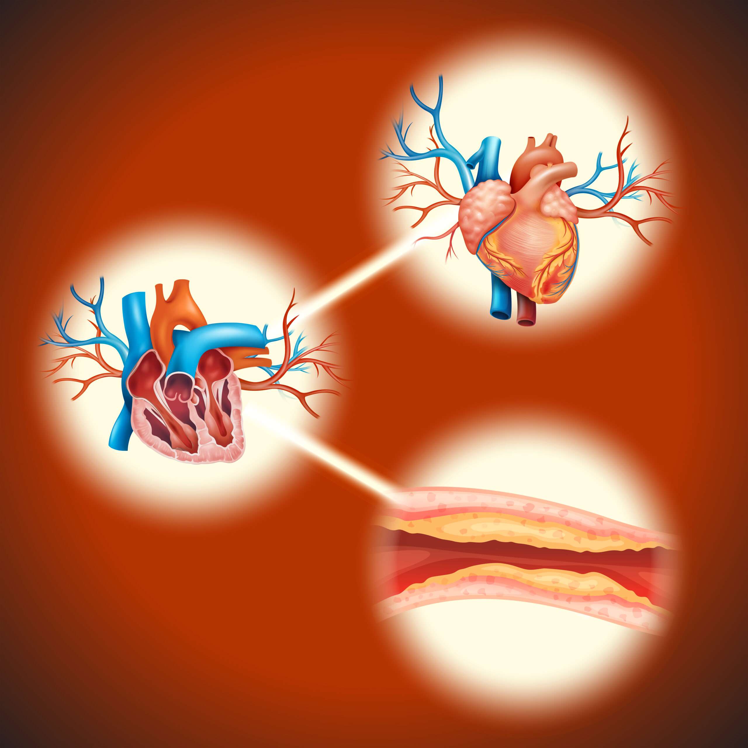 Congestive Heart Failure