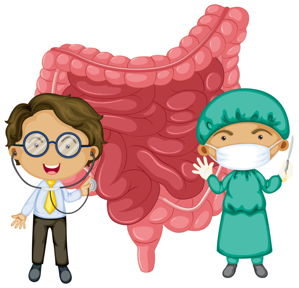 Ulcerative Colitis